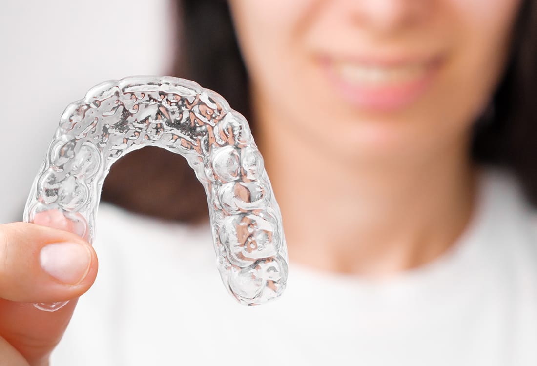 Invisalign clear aligners