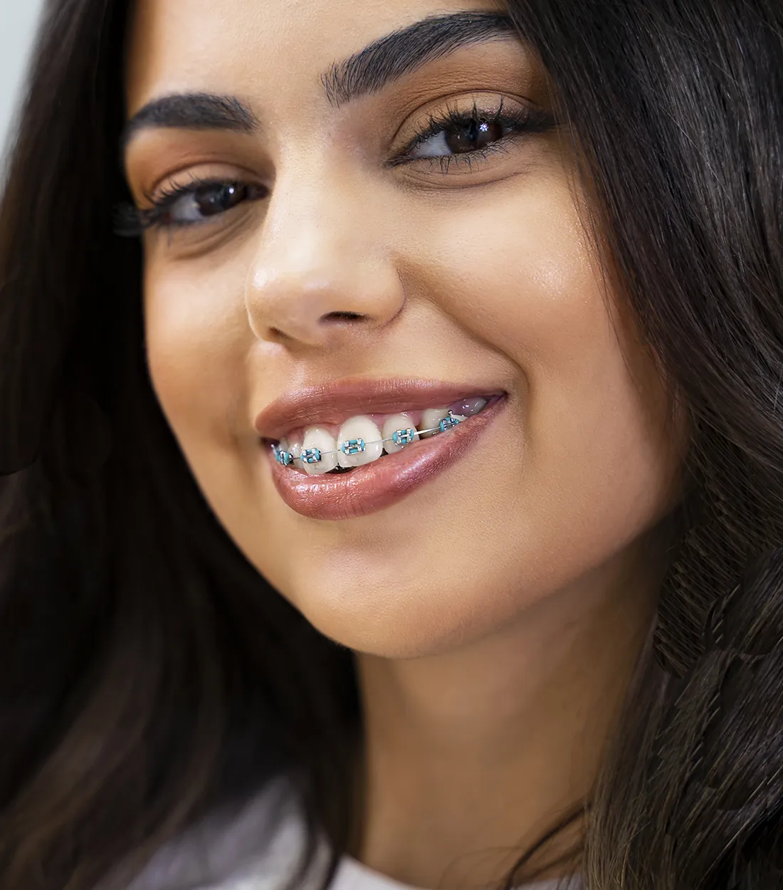 Want to find the best braces color for you?