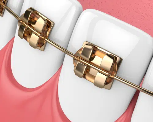 What parts are gold-colored?
