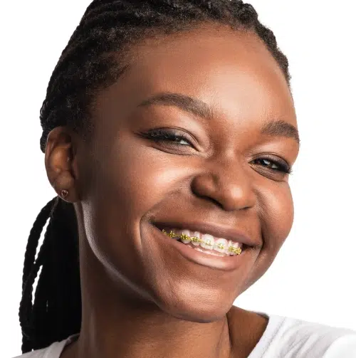 Gold braces at Augusta Orthodontics