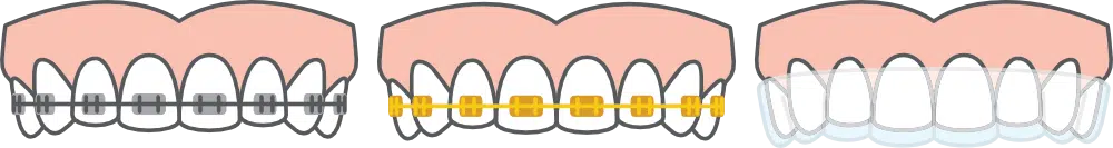 Adult ortho options from augusta ortho