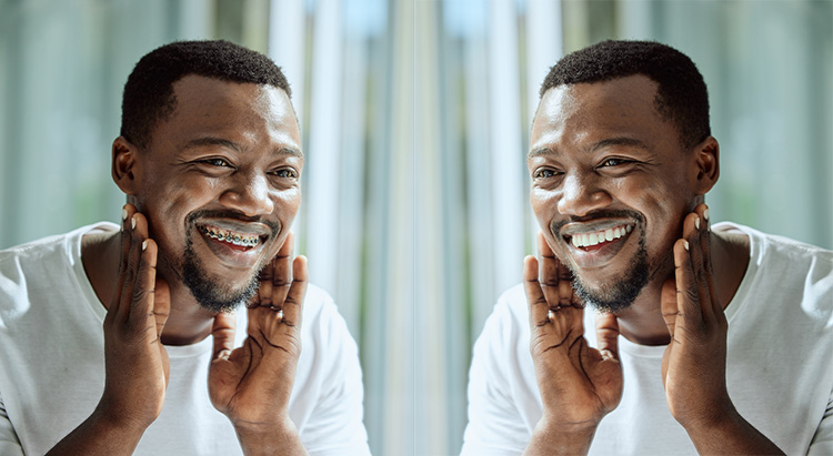 braces improve mental health
