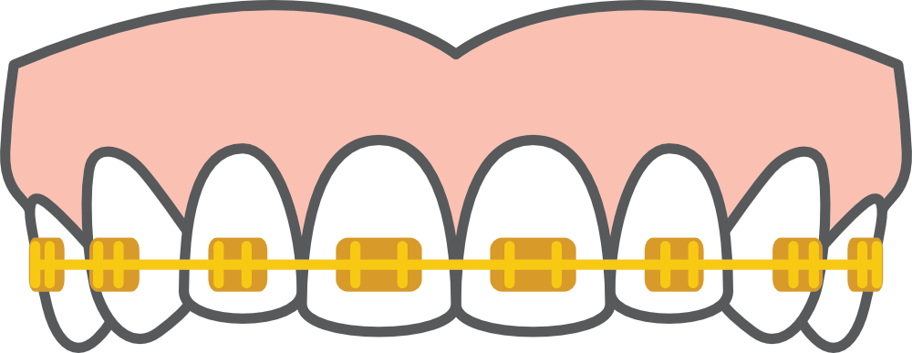 Stylish gold brackets