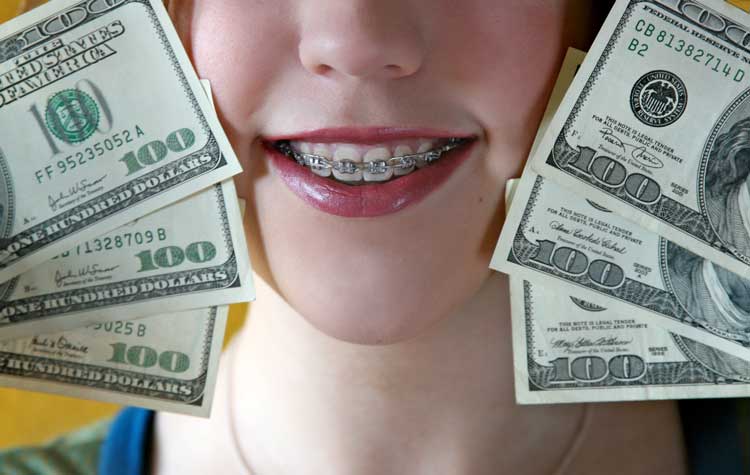 Braces provide higher lifetime income
