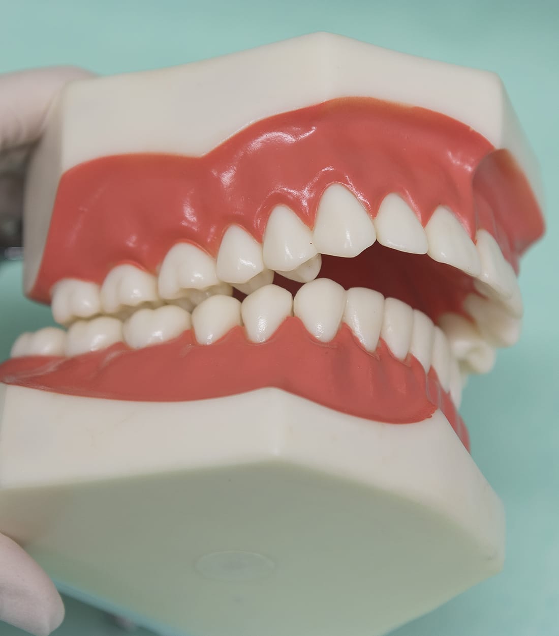Types of Open Bites Guide